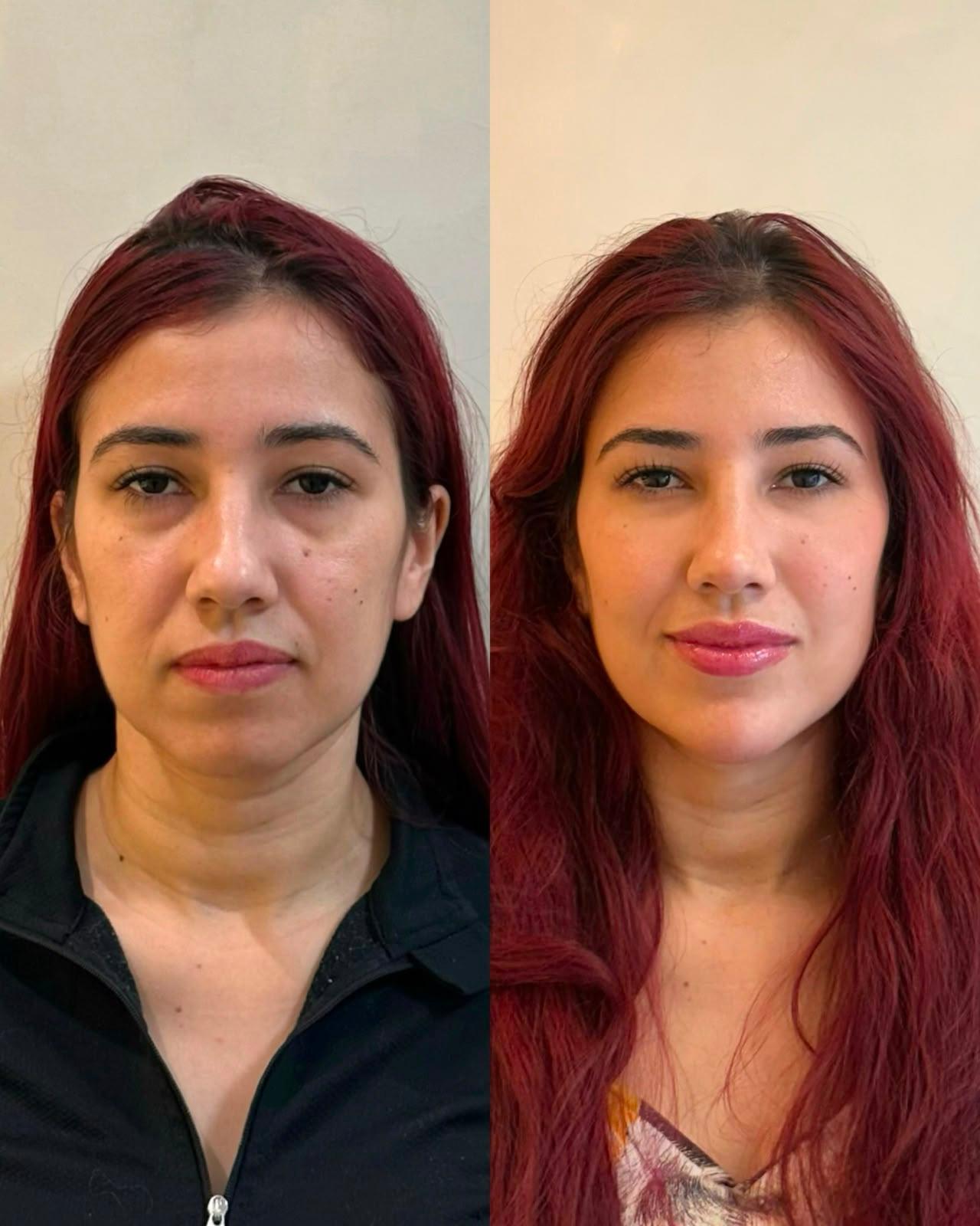 Full Face