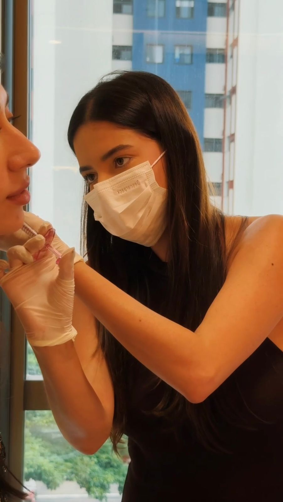 Resultado harmonização facial São Paulo — Dra. Mikaelly Cardoso